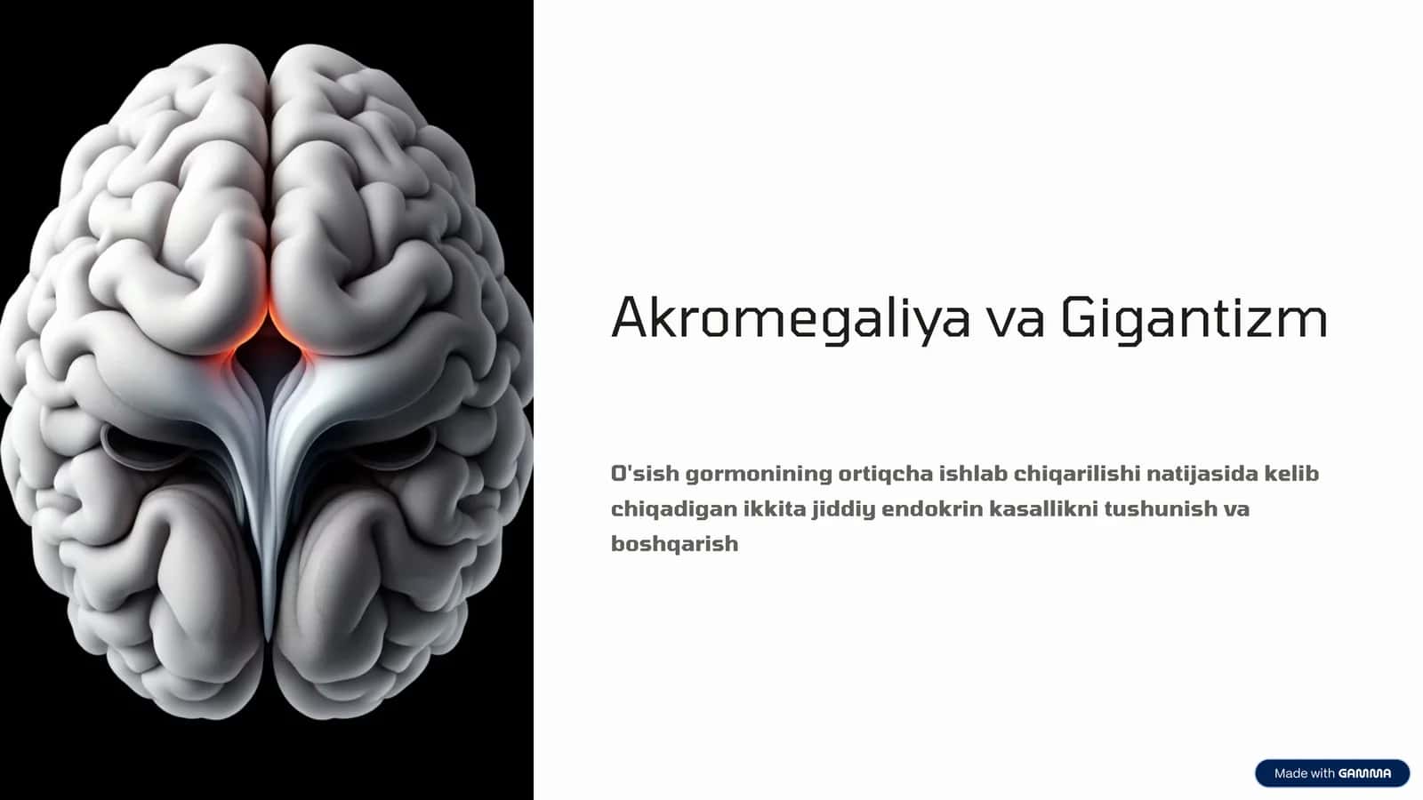 Akromegaliya va Gigantizm