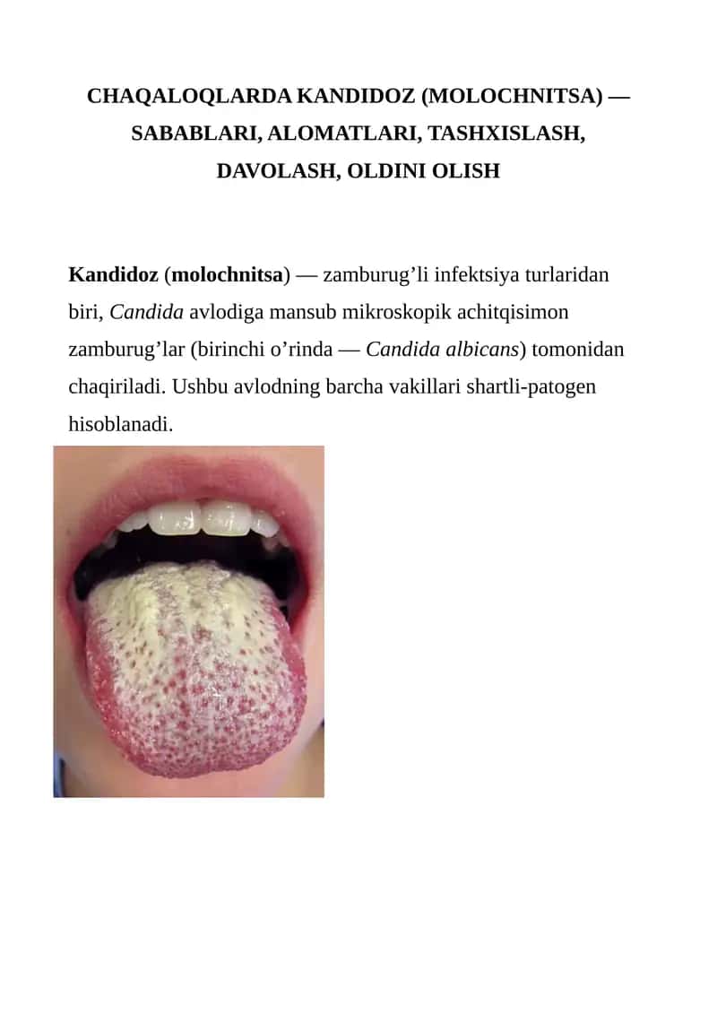 CHAQALOQLARDA KANDIDOZ (MOLOCHNITSA)