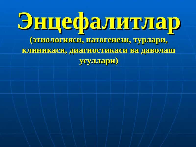 Энцефалитлар