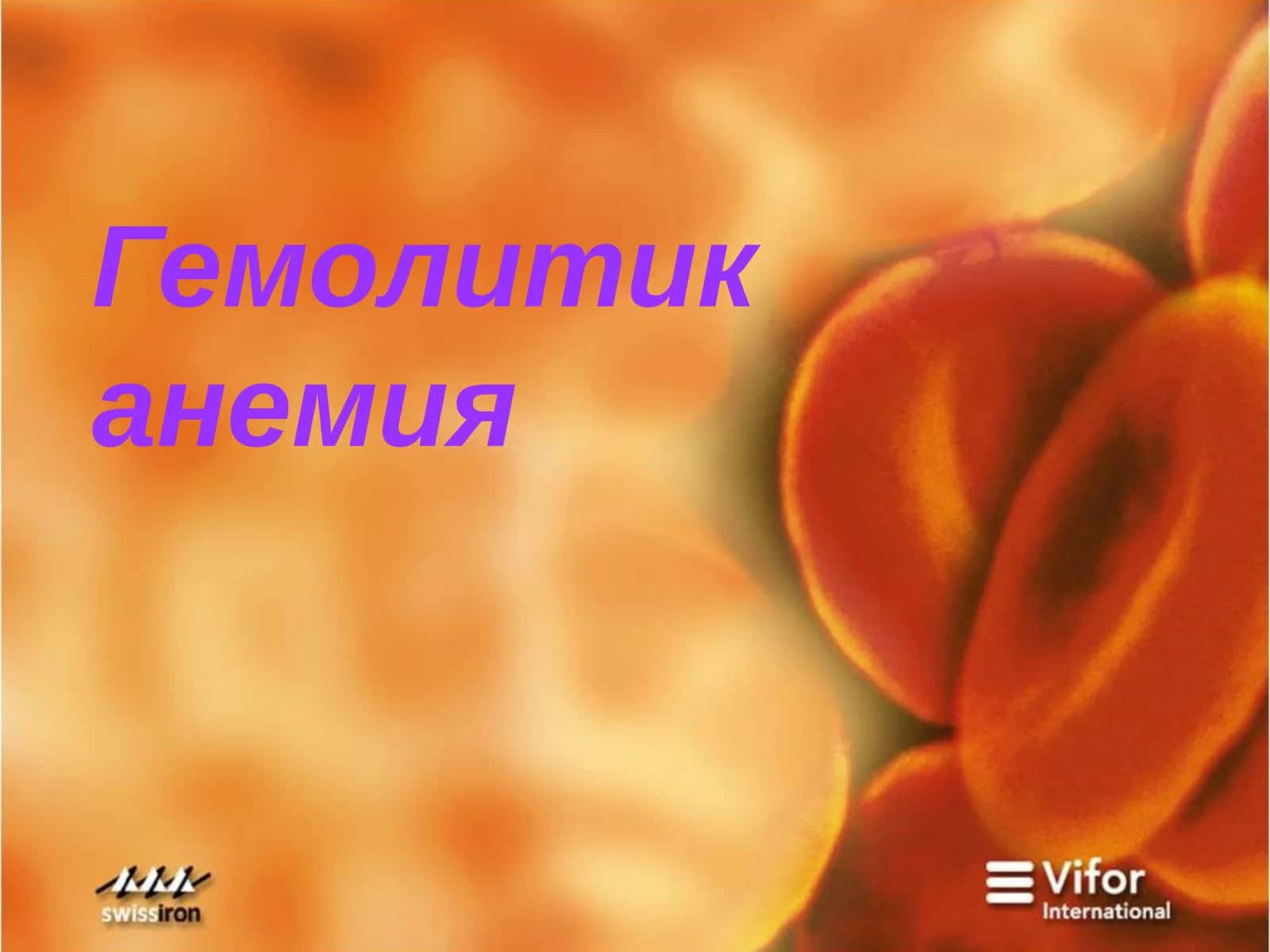 Гемолитик анемия