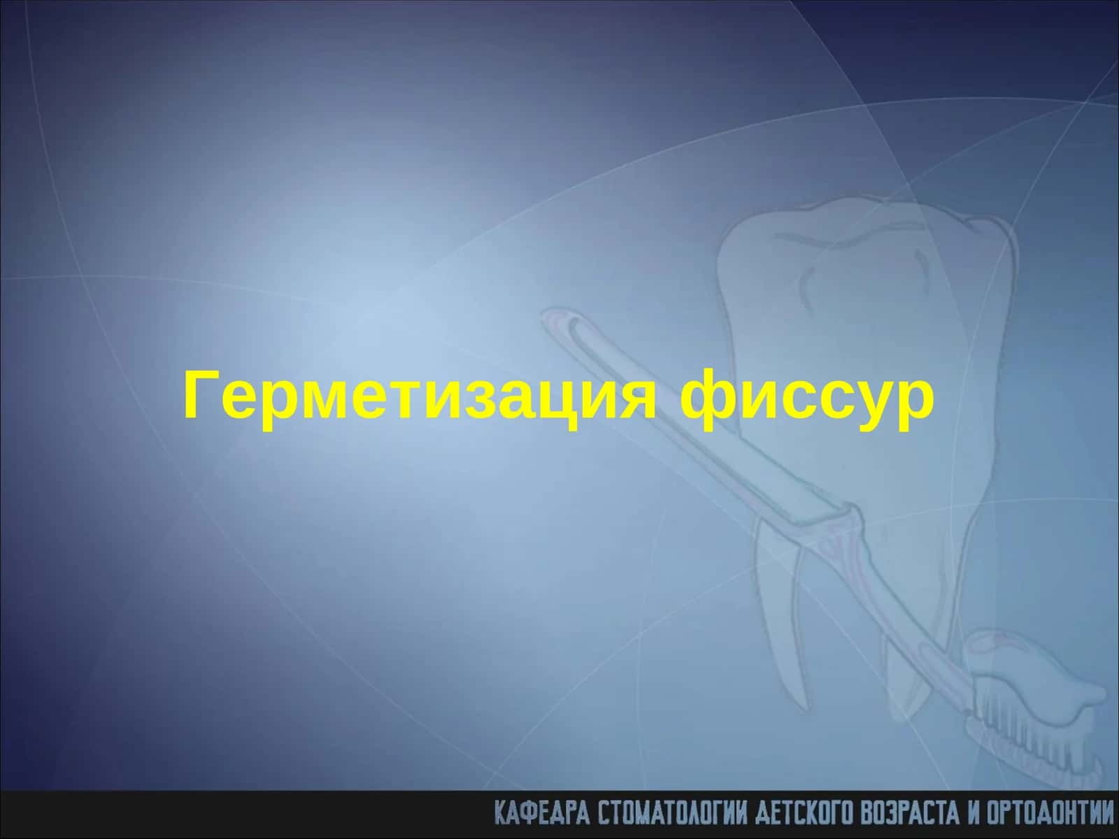 Герметизация фиссур