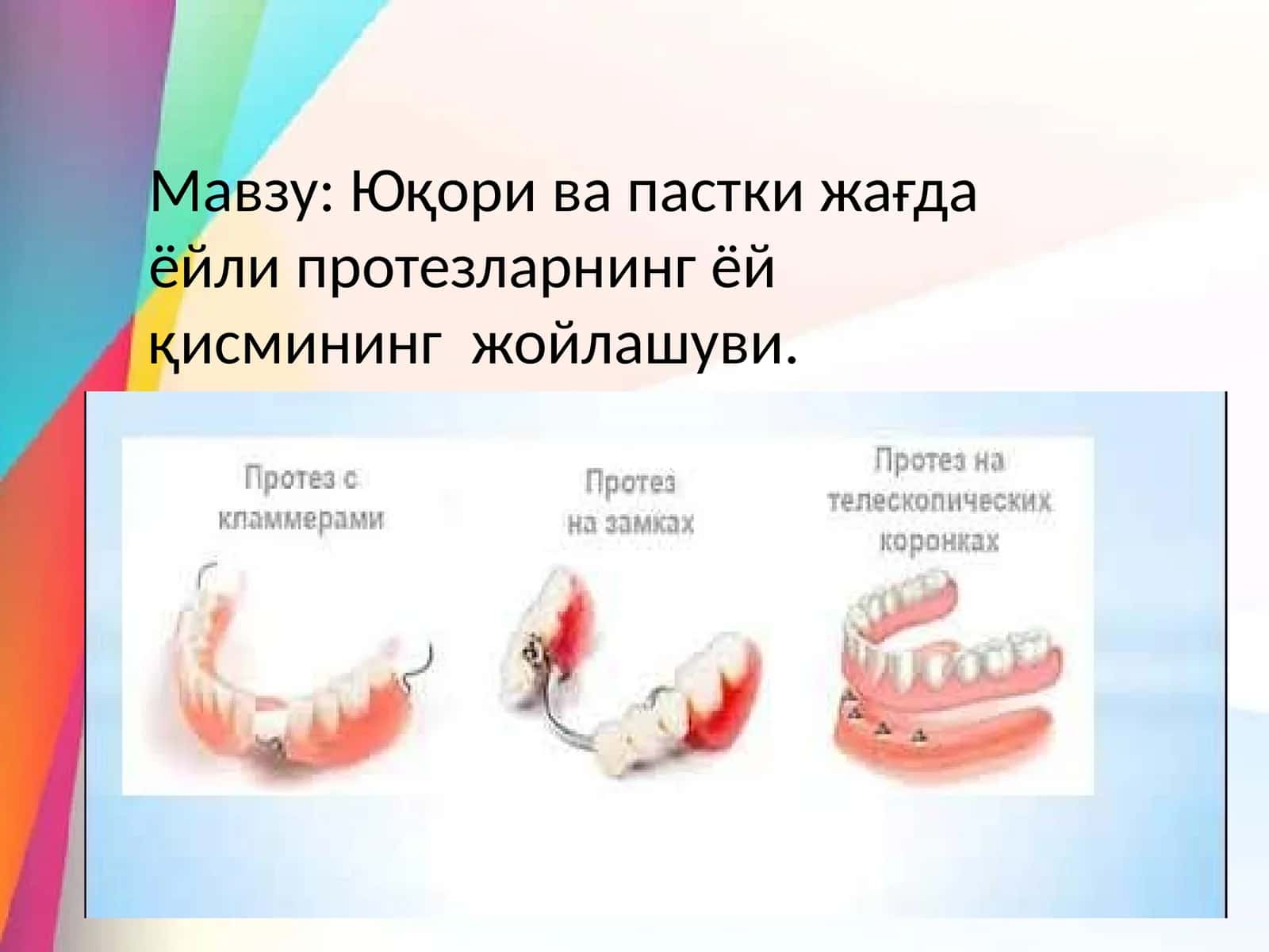 Ёйли протезлар