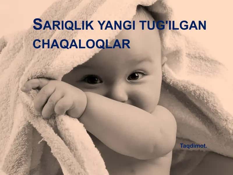 Sariqlik yangi tug'ilgan chaqaloqlar