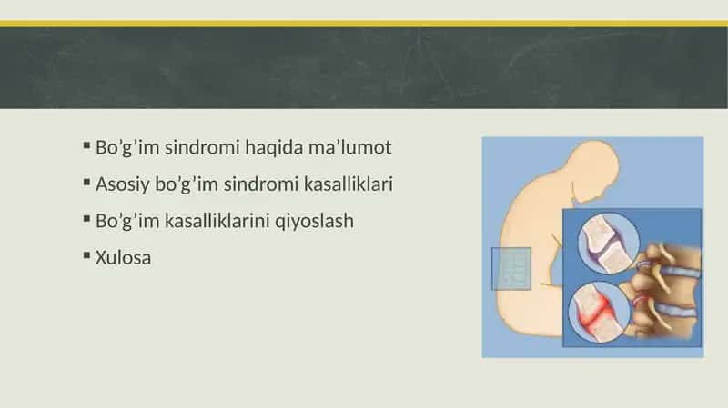 Bo'g'im sindromi haqida pptx taqdimot