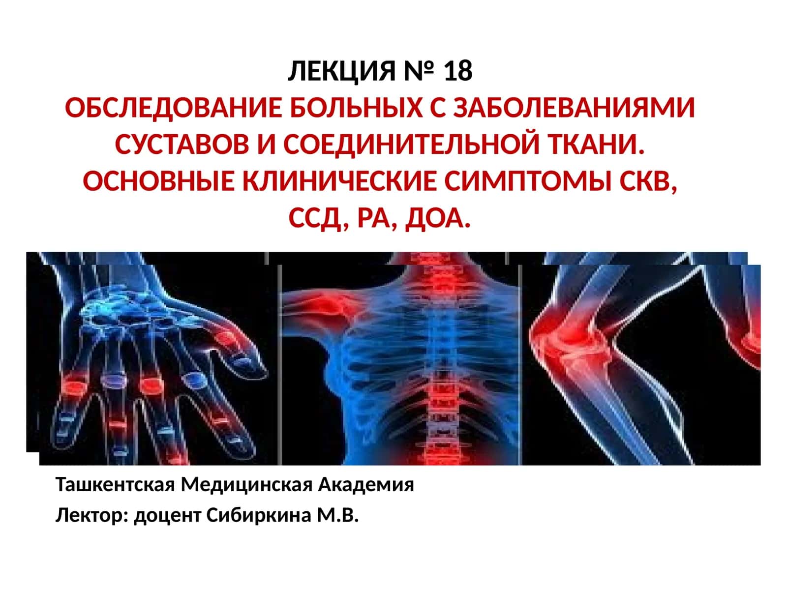 ЛЕКЦИЯ № 18ОБСЛЕДОВАНИЕ БОЛЬНЫХ С ЗАБОЛЕВАНИЯМИ СУСТАВОВ И СОЕДИНИТЕЛЬНОЙ ТКАНИ. ОСНОВНЫЕ КЛИНИЧЕСКИЕ СИМПТОМЫ СКВ, ССД, РА, ДОА