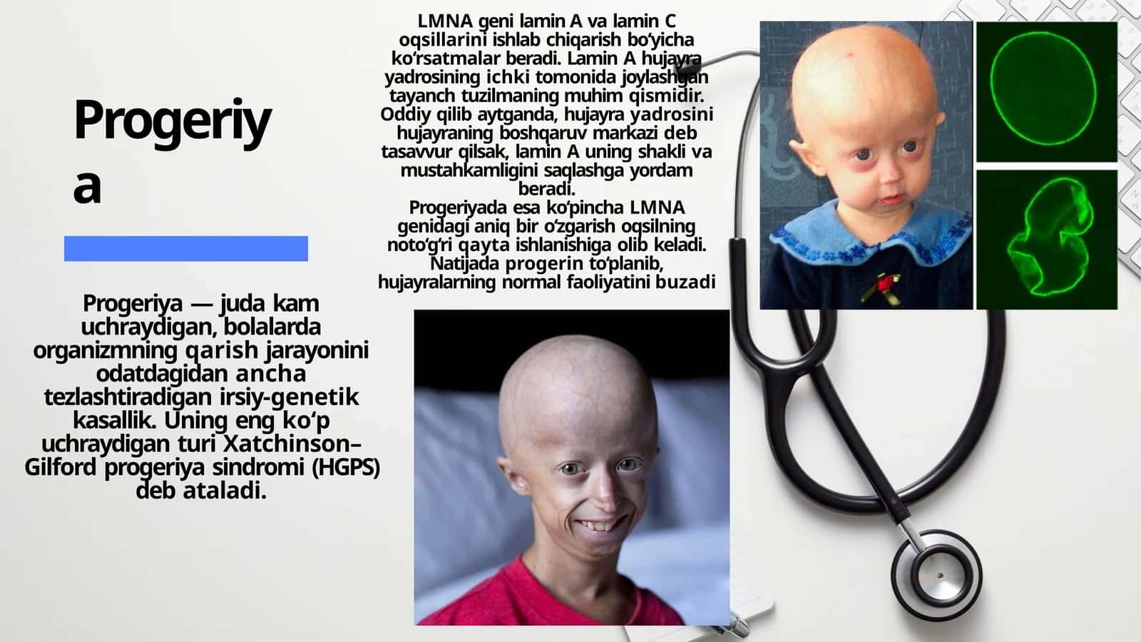 Progeriya