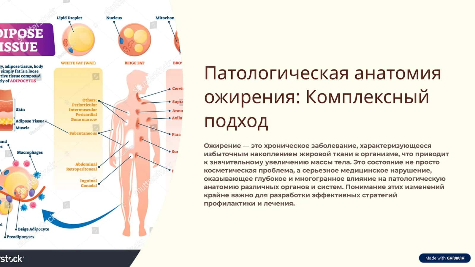 Патологическая анатомия ожирения: Комплексный подход