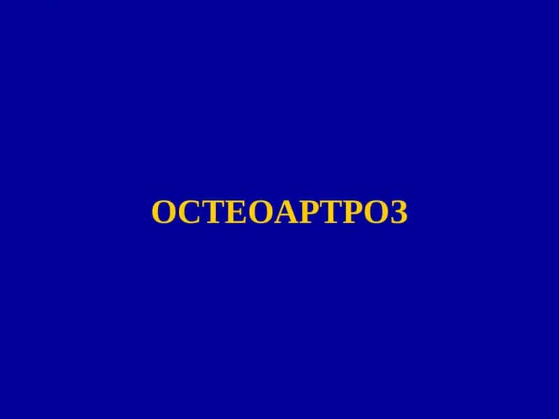 Остеоартроз