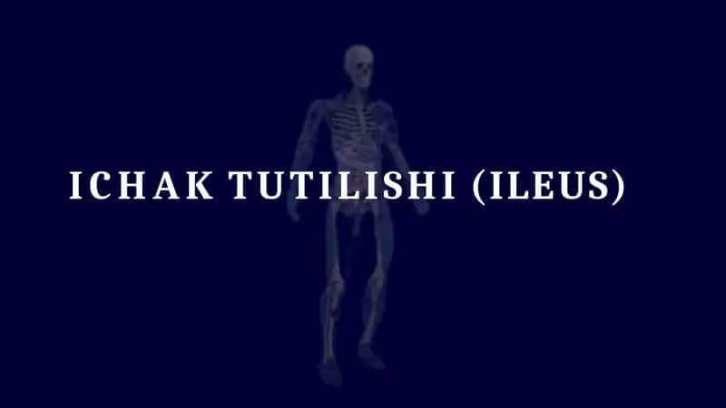 Ichak tutilishi taqdimot