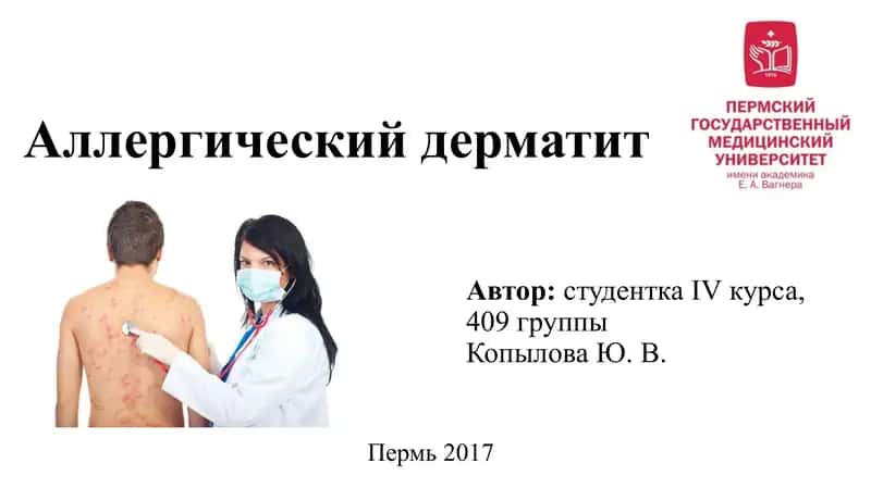 Аллергический дерматит