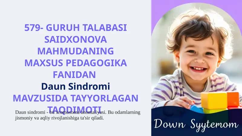 DaunSindromi