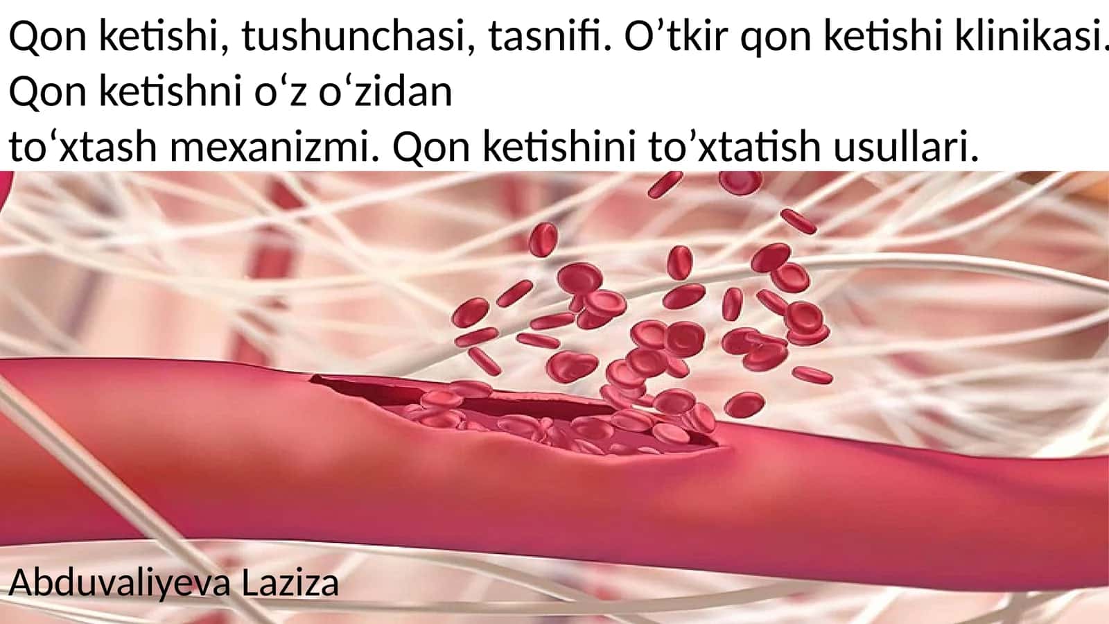 QON KETISHI