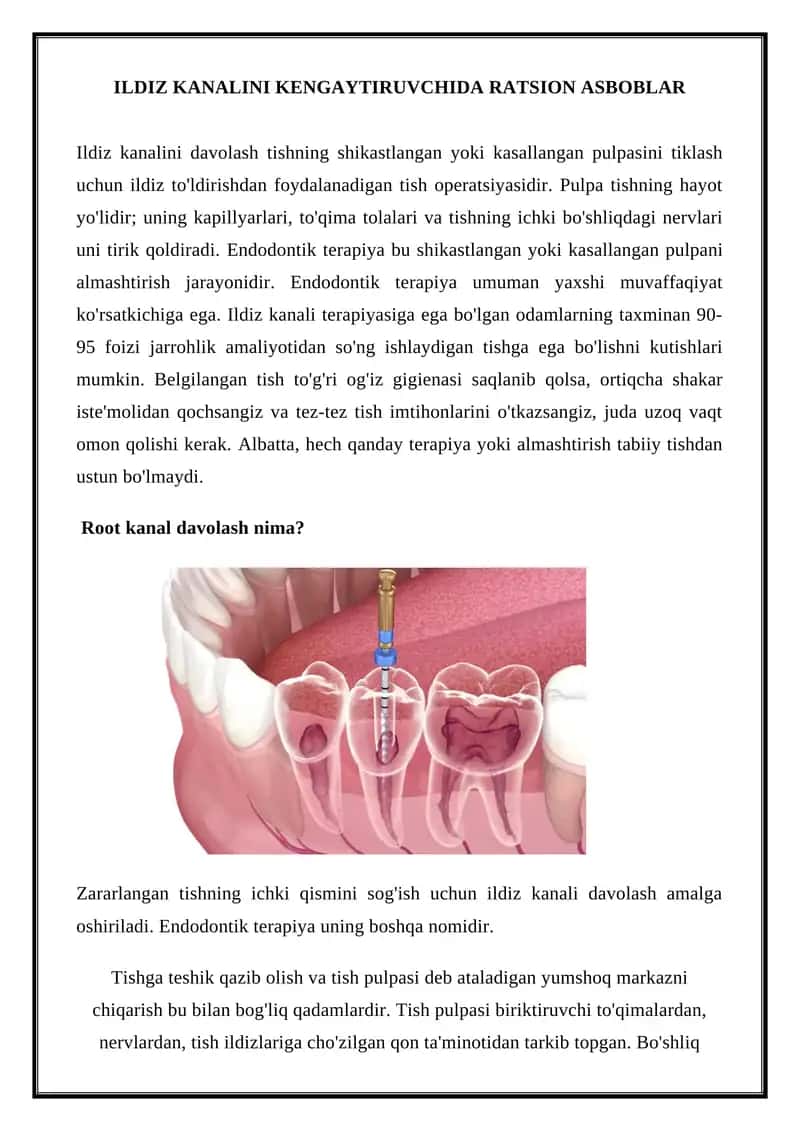 Ildiz kanali terapiyasi