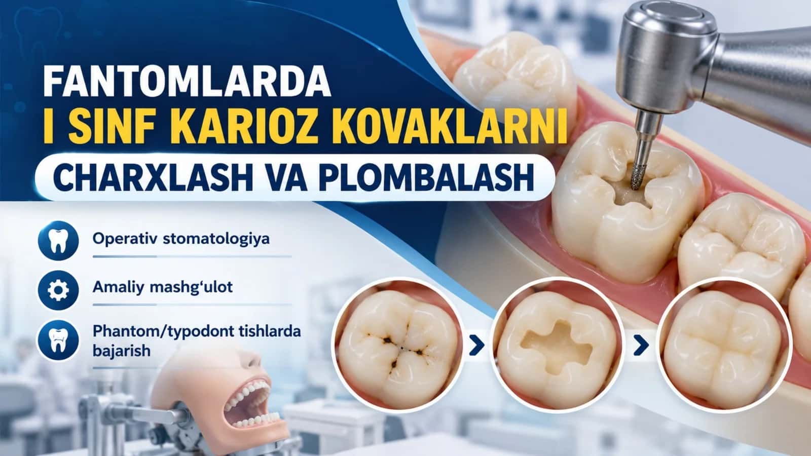 Fantomlarda I sinf karioz kovaklarni charxlash va plombalash.pptx