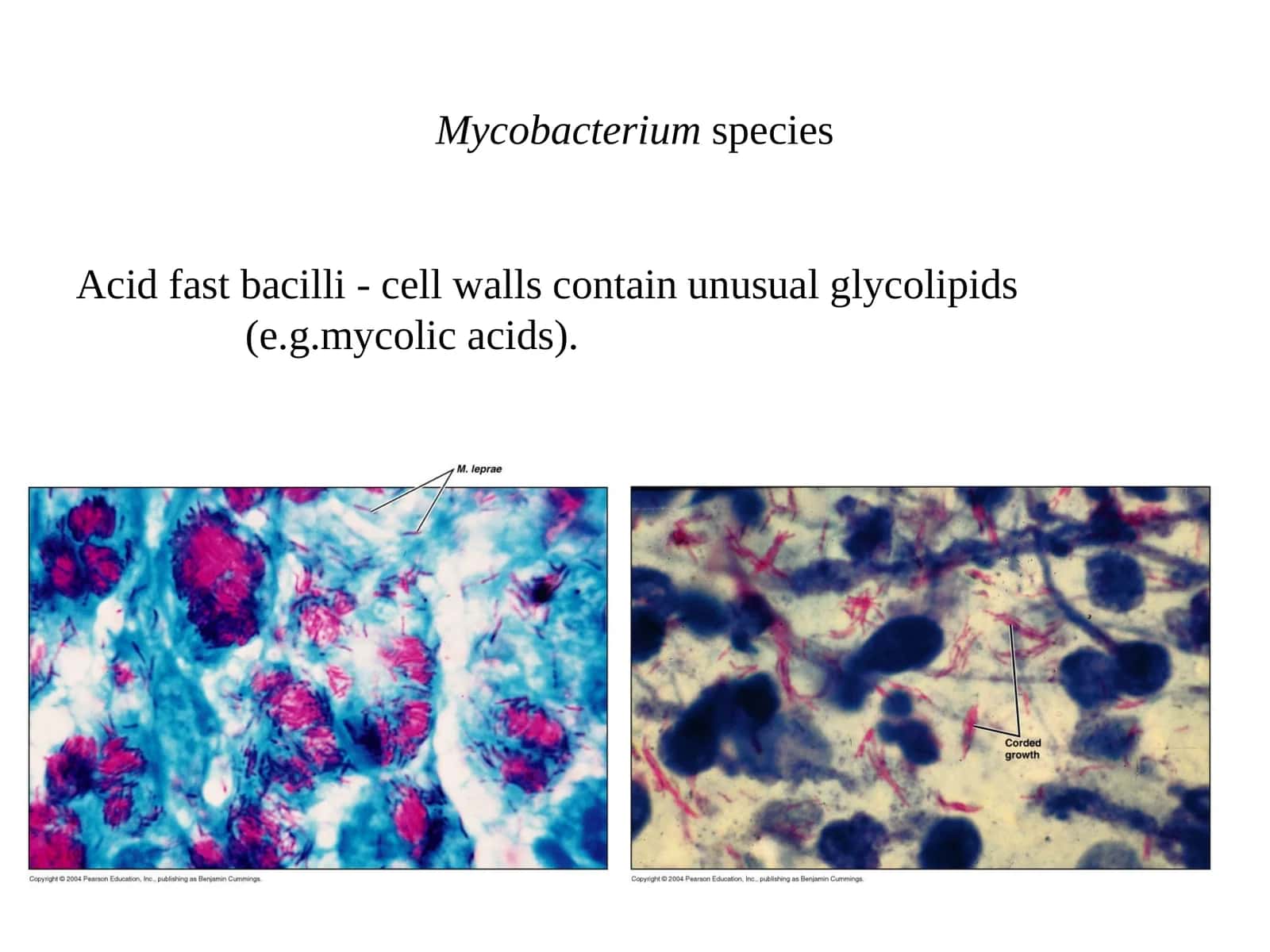 Mycobacterium species Acid fast bacilli - cell walls contain unusual glycolipids (e.g.mycolic acids).