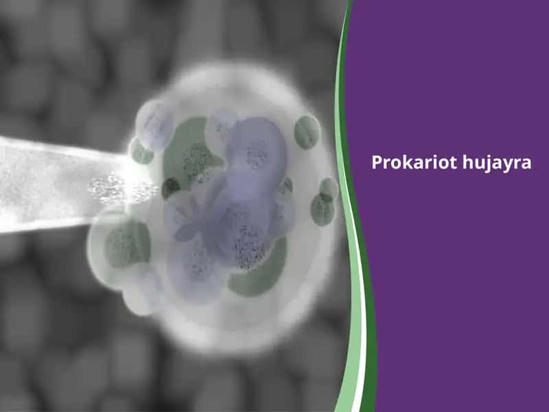 Prokariot hujayra
