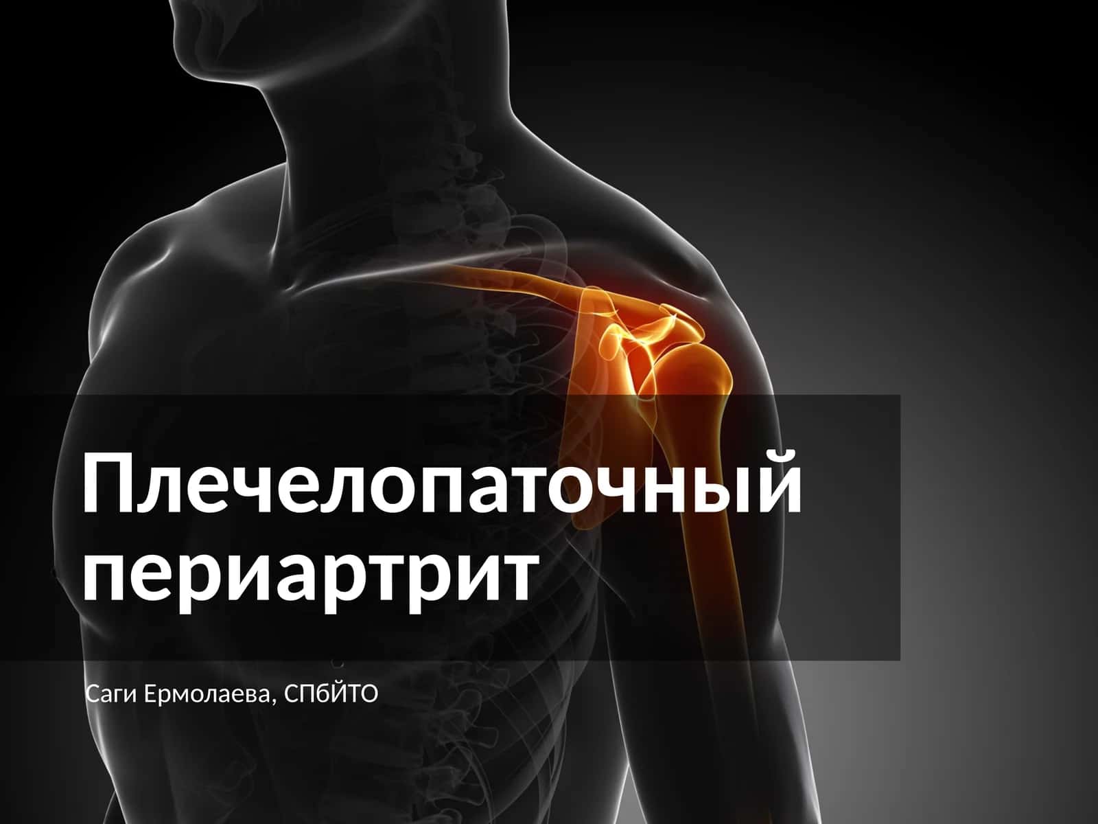 Плечелопаточный периартрит