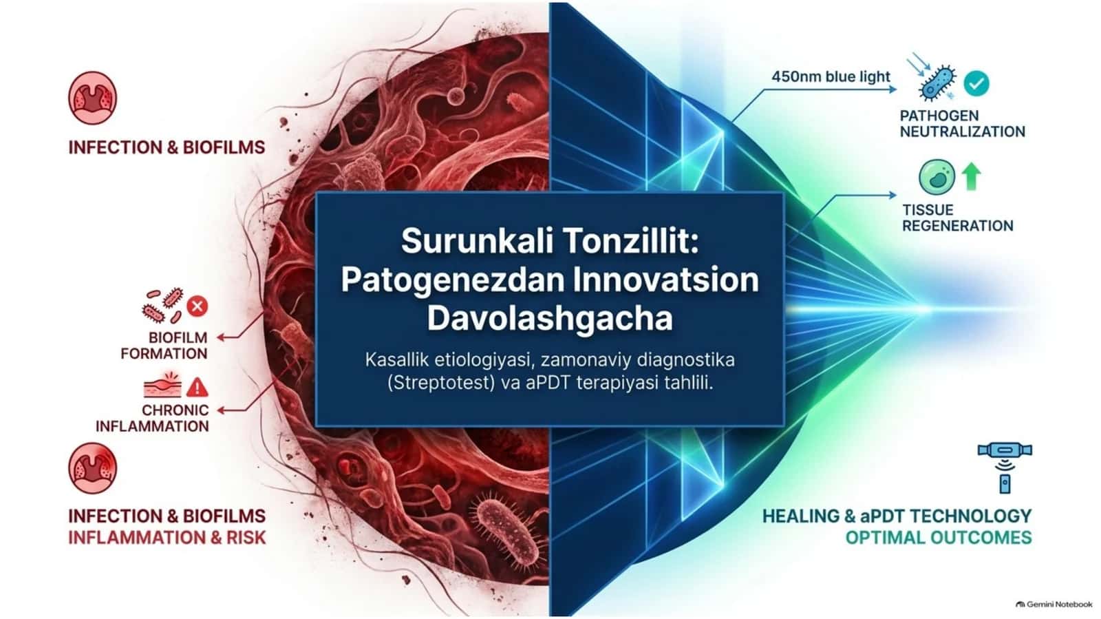 Surunkaliy tonzilit