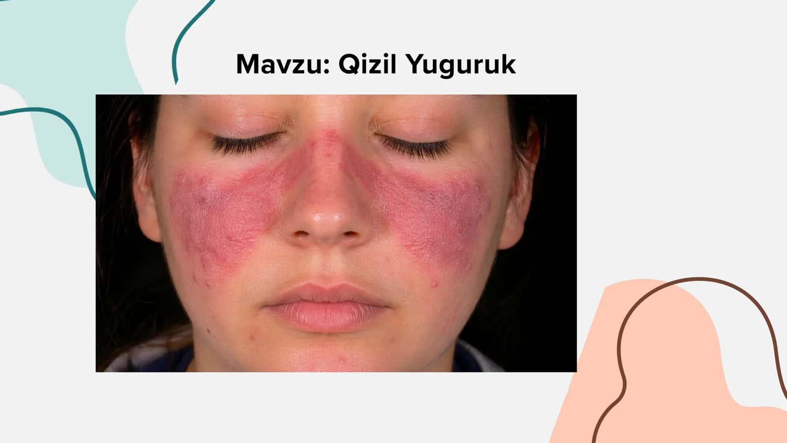Qizil Yuguruk