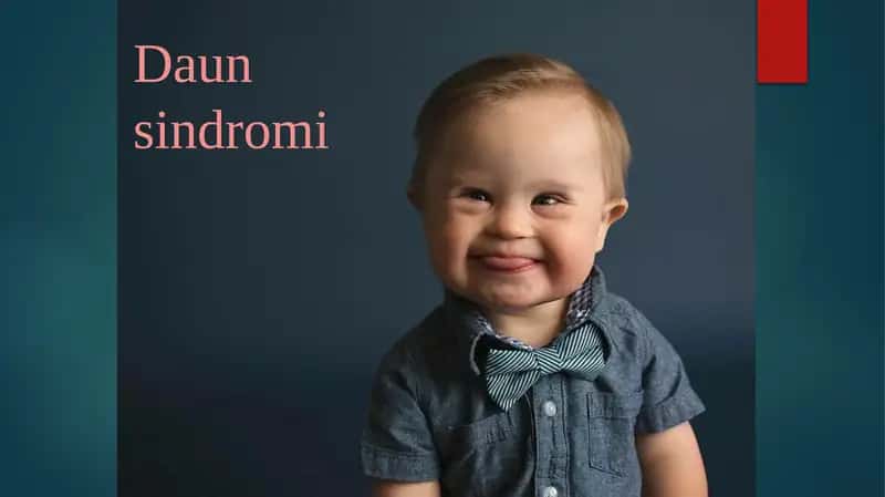 Daunsindromi